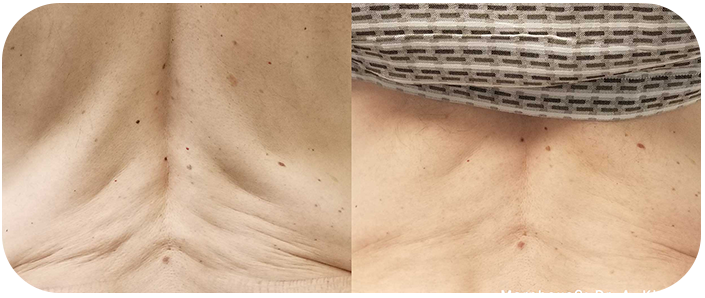 transiton2